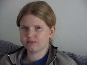 Sarah's post-op swelling